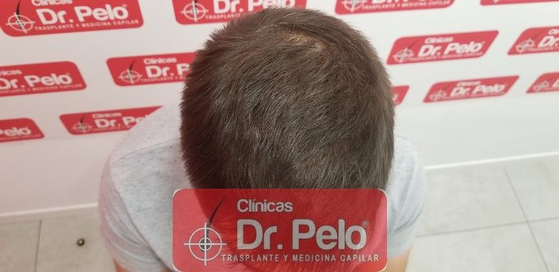 [Imagen: tratamiento-capilar-dr-pelo-sevilla-bada...ida_12.jpg]