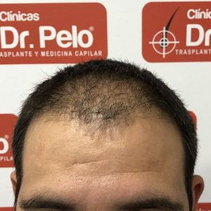 [Imagen: tratamiento-capilar-dr-pelo-10-300x300.jpg]