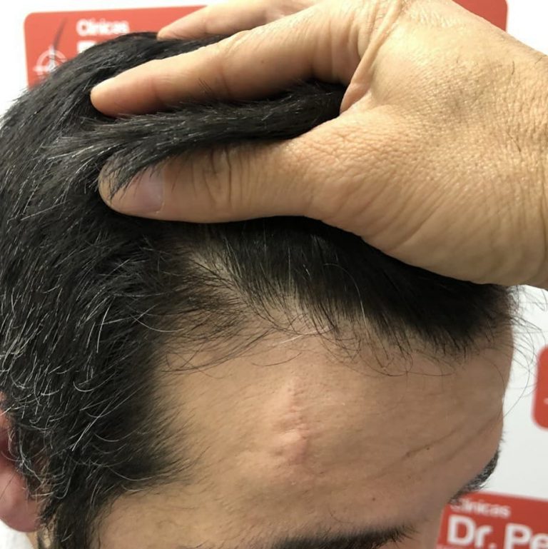 [Imagen: tratamiento-capilar-dr-pelo-2-768x769.jpg]